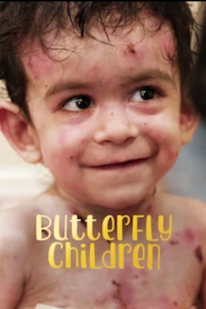 Những đứa trẻ da cánh bướm (Butterfly Children) [2018]